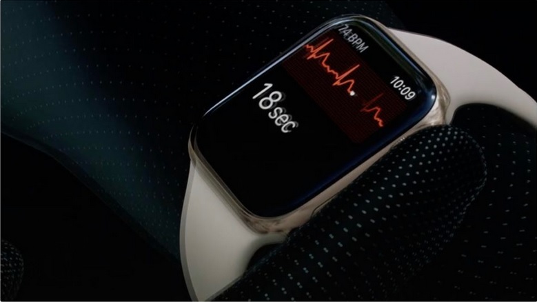 ecg review apple watch
